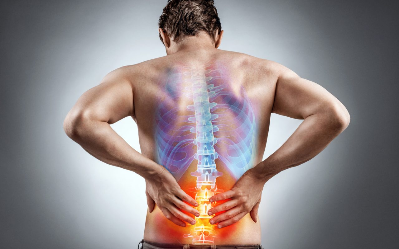Rückenschmerzen: Ihre Apotheke hilft 